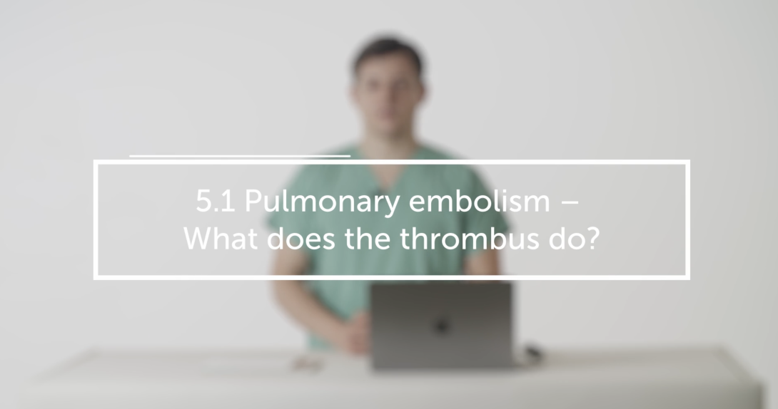 Pulmonary embolism – What does the thrombus do?