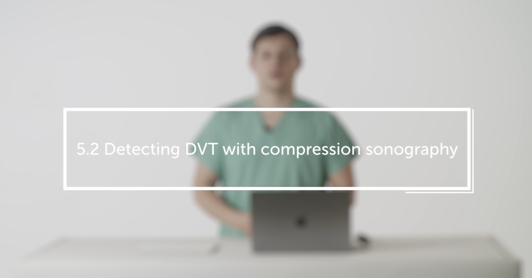 Detecting DVT with compression sonography