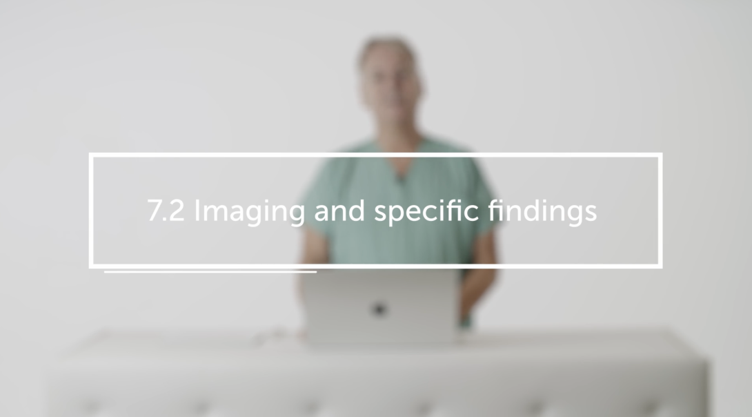 Imaging and specific findings
