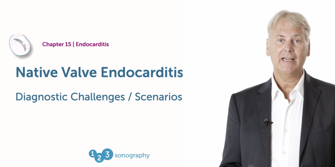 Native Valve Endocarditis - Diagnostic Challenges / Scenarios