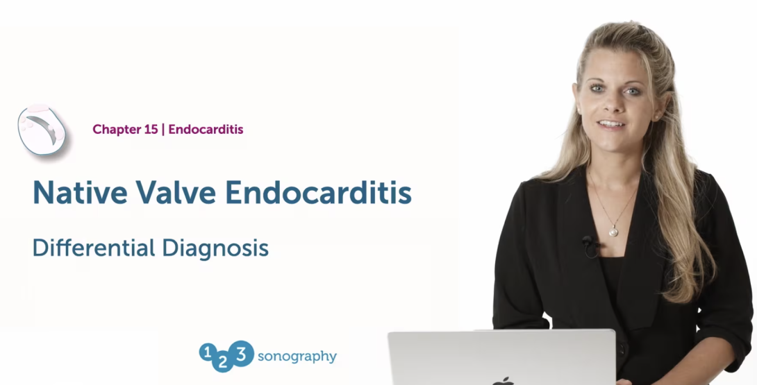 Native Valve Endocarditis - Differential Diagnosis