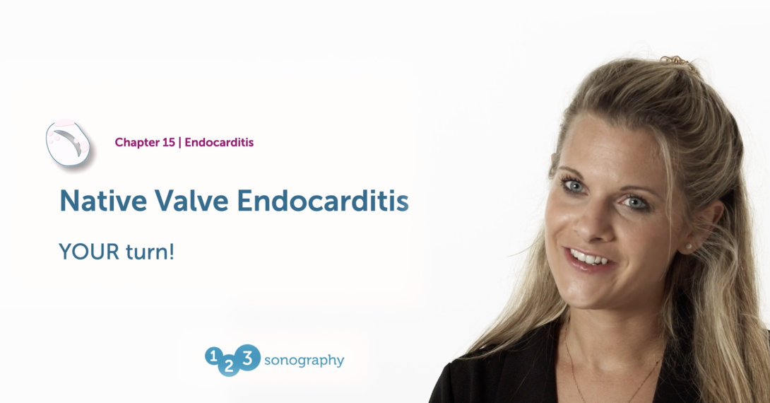 Native Valve Endocarditis - Your turn to diagnose endocarditis!