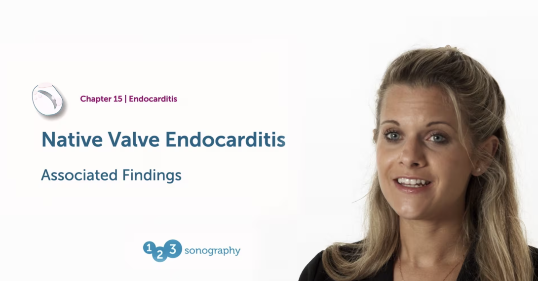 Native Valve Endocarditis - Associated Findings