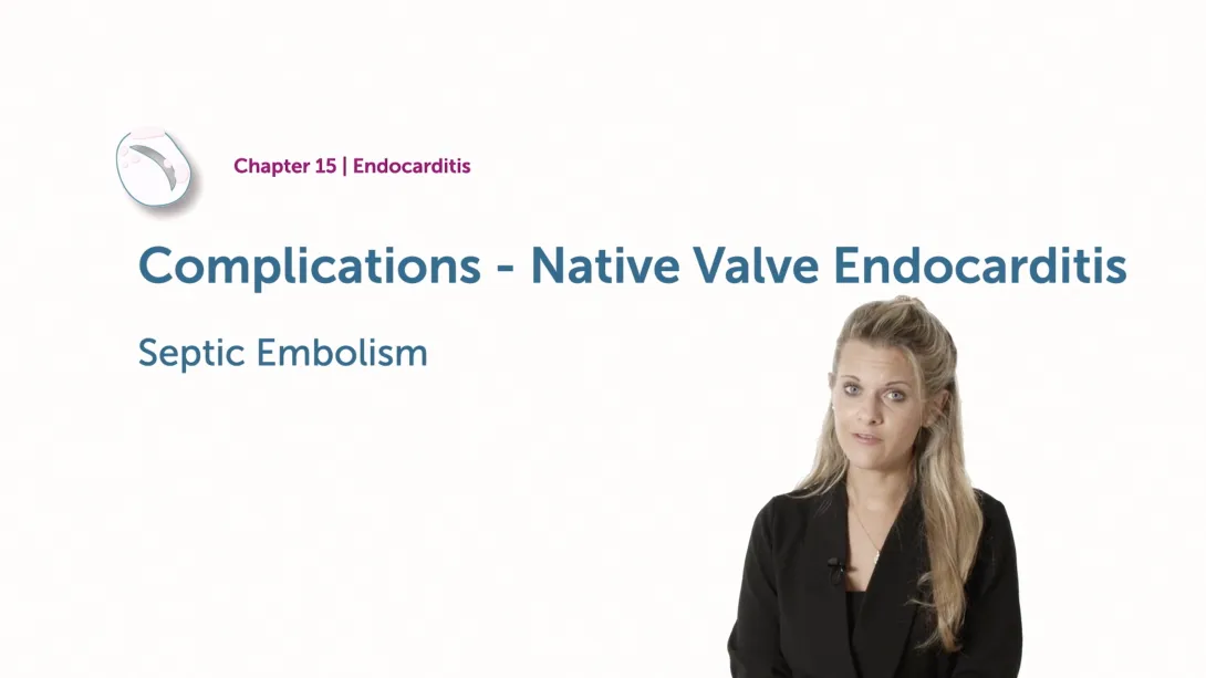 Septic Embolism