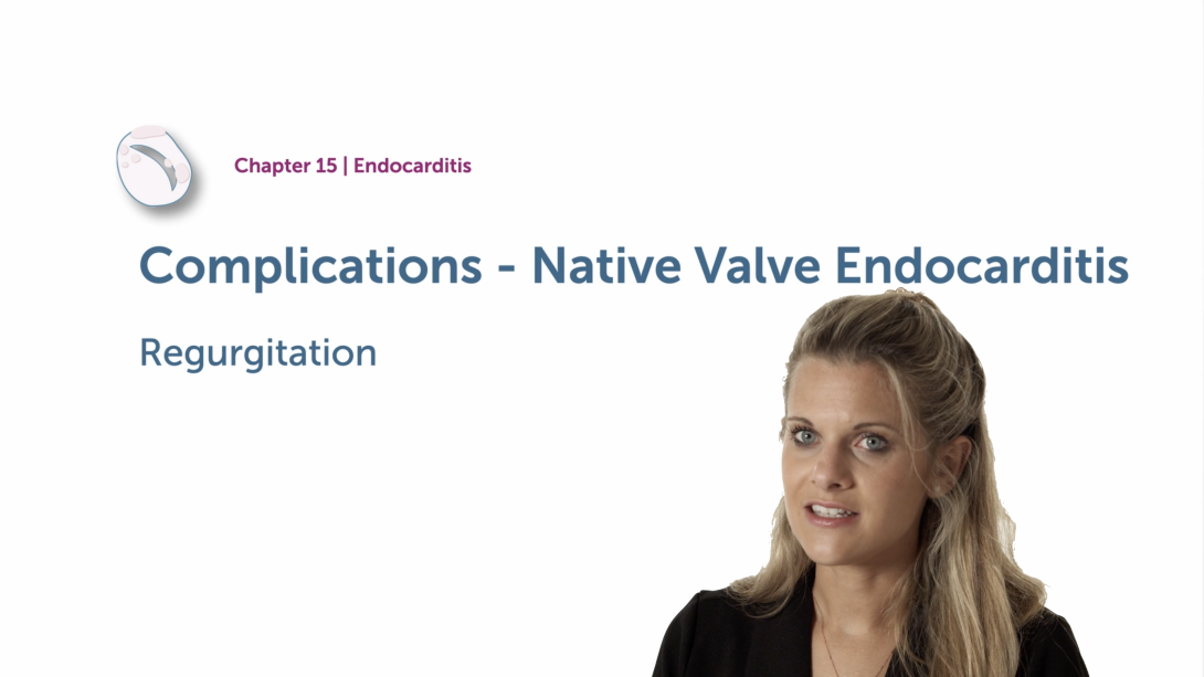 Complications of Native Valve Endocarditis - Regurgitation