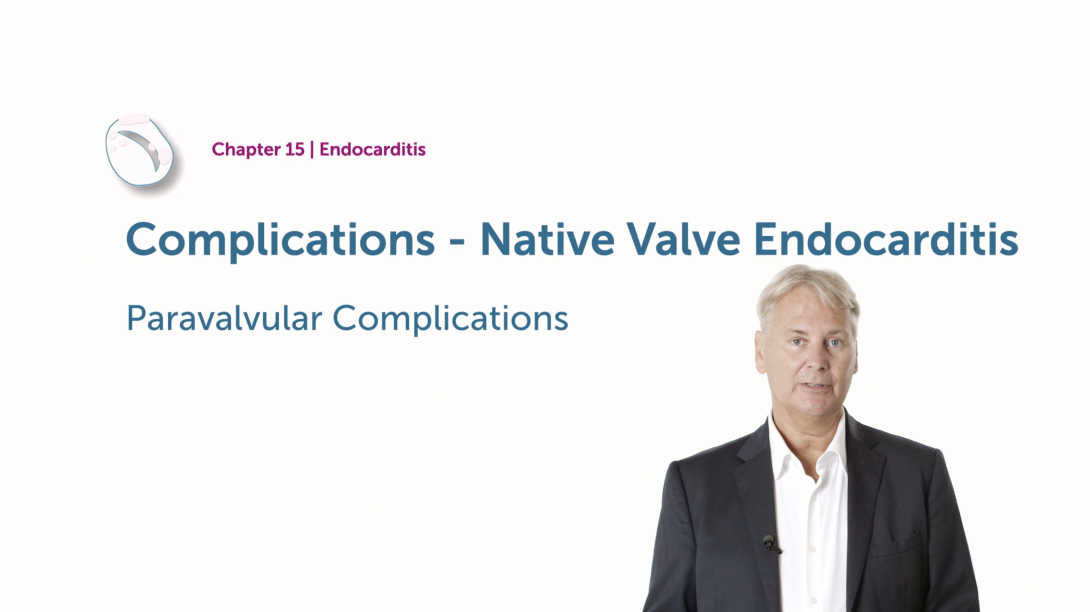Complications of Native Valve Endocarditis - Paravalvular Complications