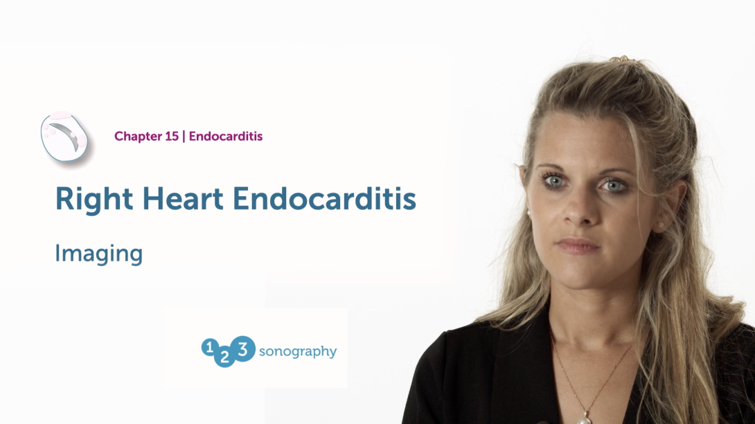 Right Heart Endocarditis - Imaging