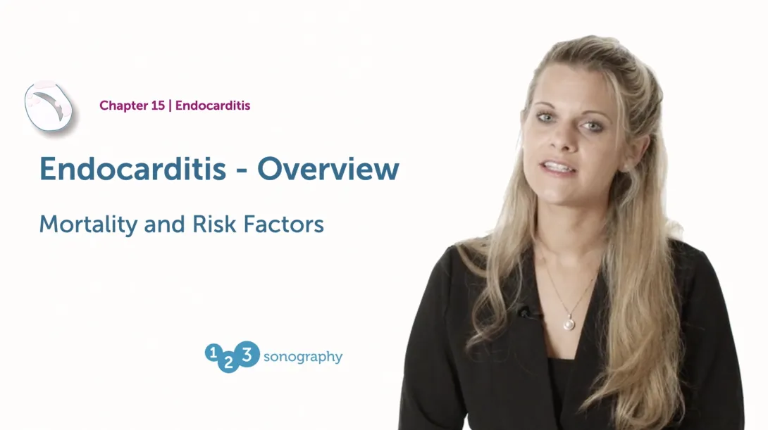 Mortality and Risk