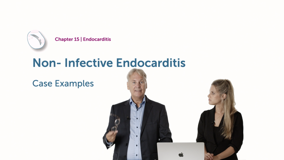 Non-Infective Endocarditis - Case Examples