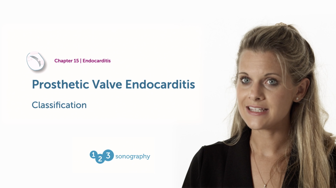Prosthetic Valve Endocarditis - Classification