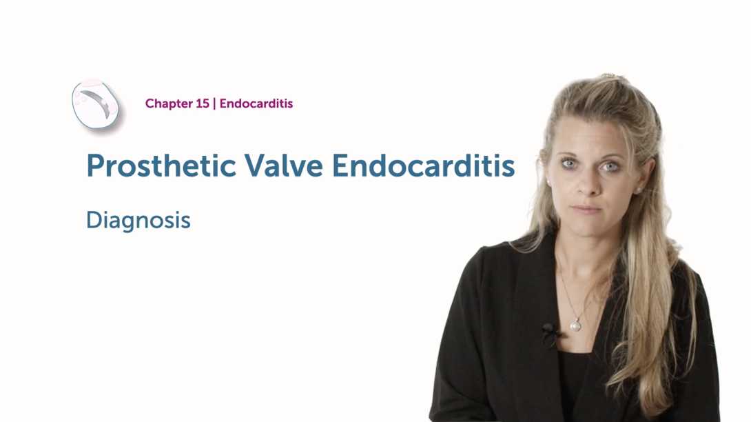 Prosthetic Valve Endocarditis - Diagnostic Challenges