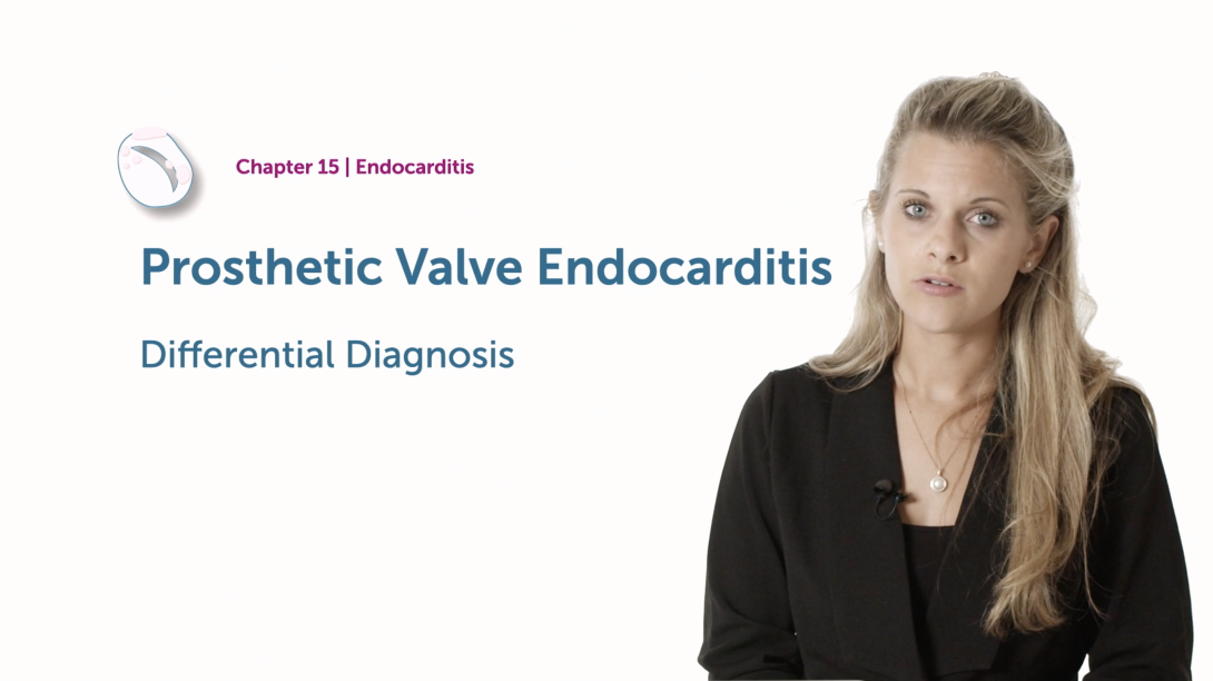 Prosthetic Valve Endocarditis - Differential Diagnosis