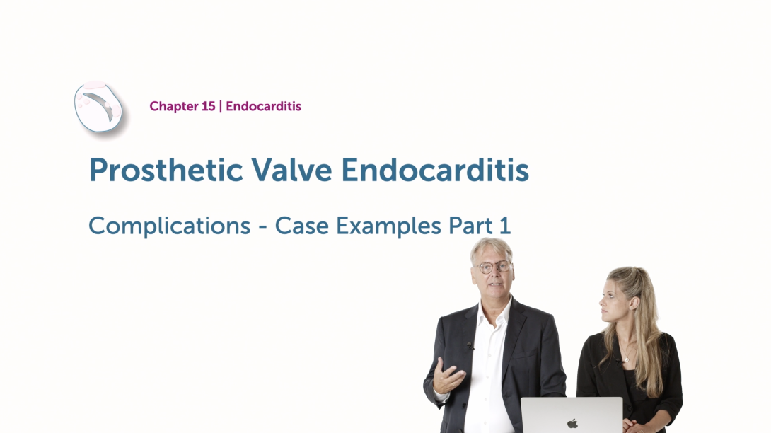 Prosthetic Valve Endocarditis - Complications - Part 1