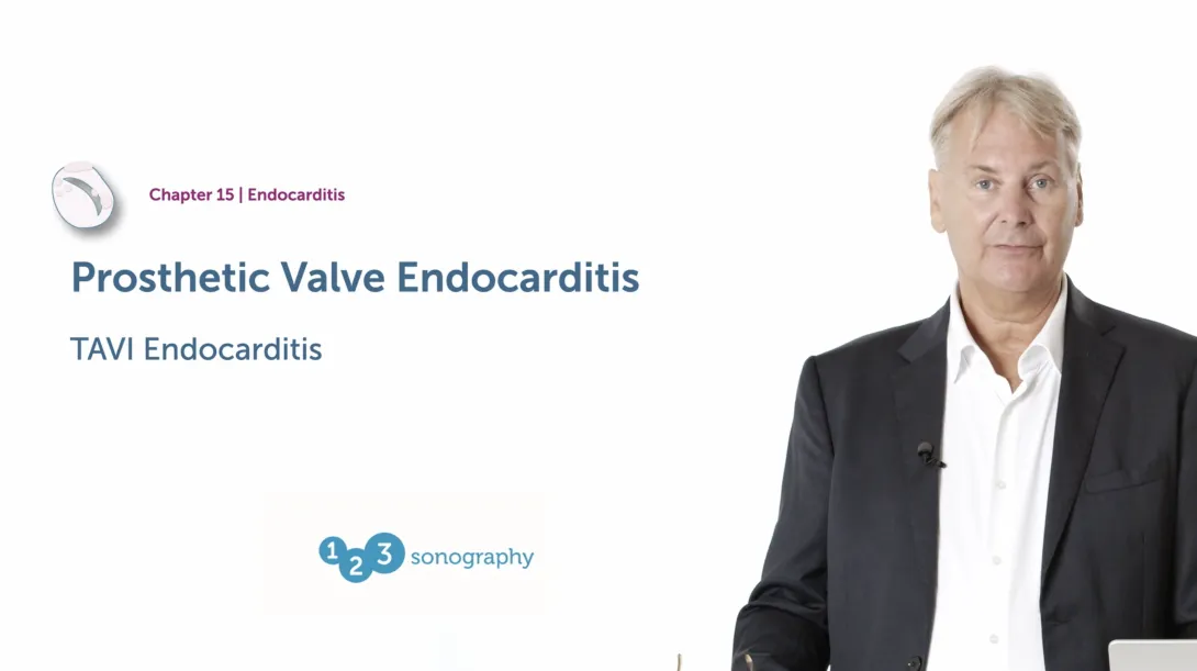TAVI Endocarditis