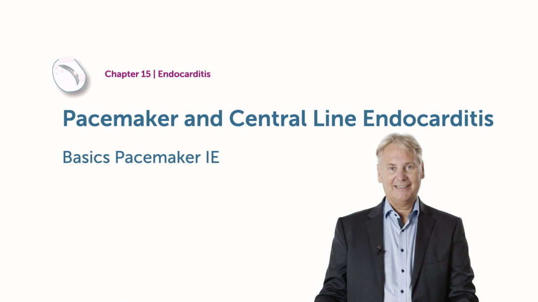 Pacemaker and Central Line Endocarditis - Basics