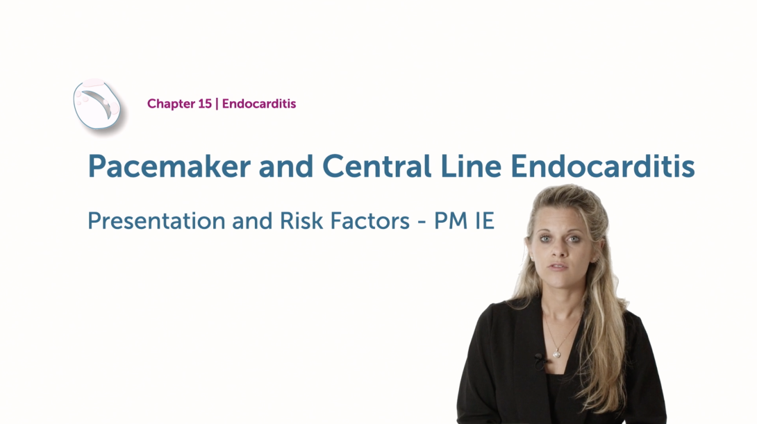 Pacemaker and Central Line Endocarditis - Presentation + Risk factors