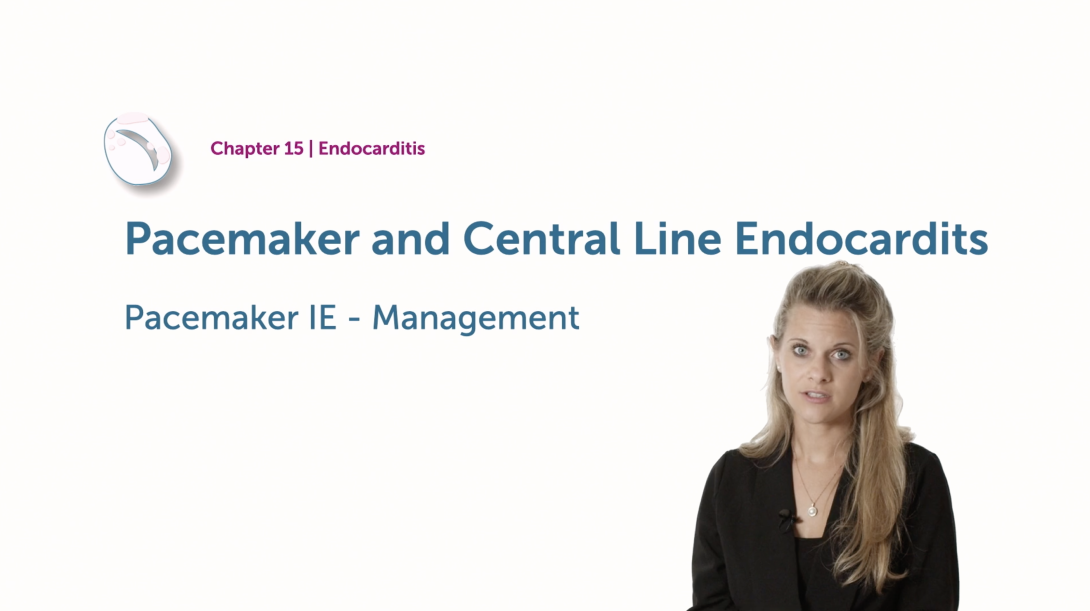 Pacemaker and Central Line Endocarditis - Management
