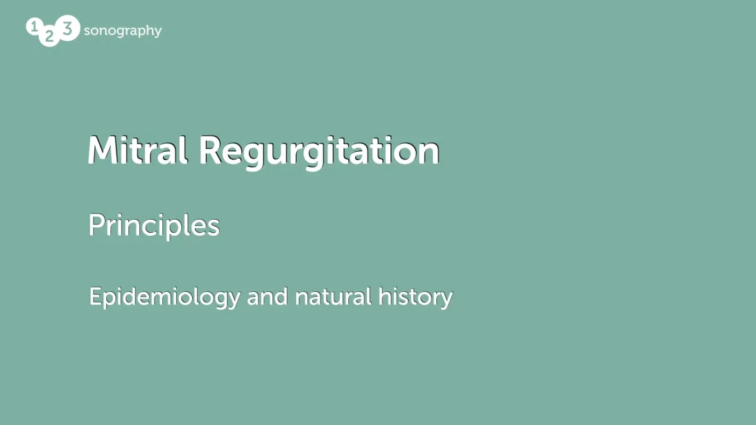 Epidemiology and natural history