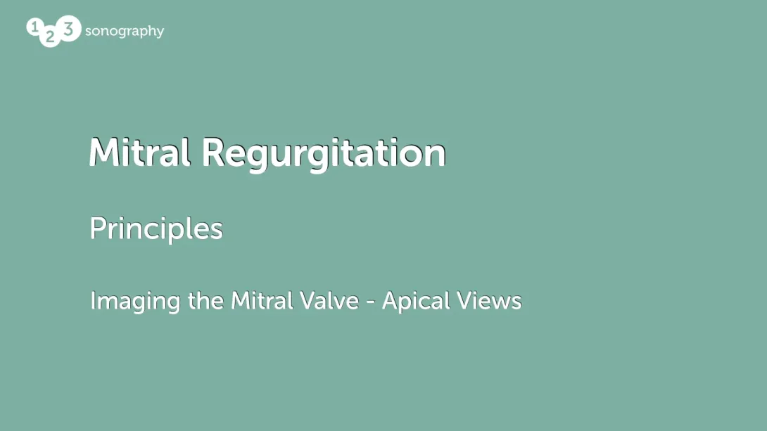 Imaging the Mitral Valve - Apical Views