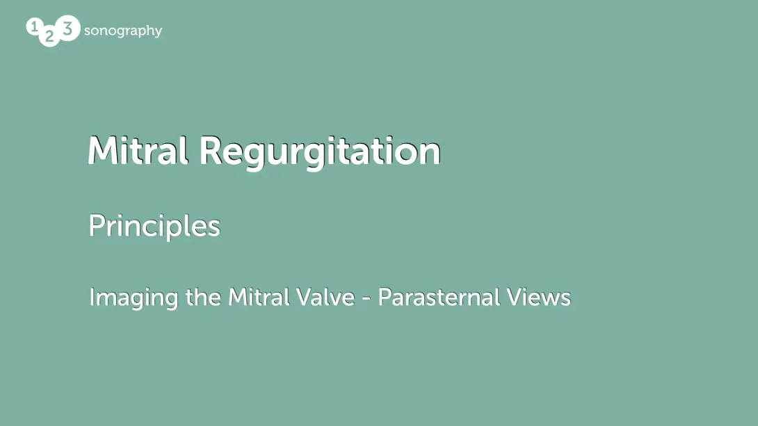 Imaging the Mitral Valve - Parasternal Views