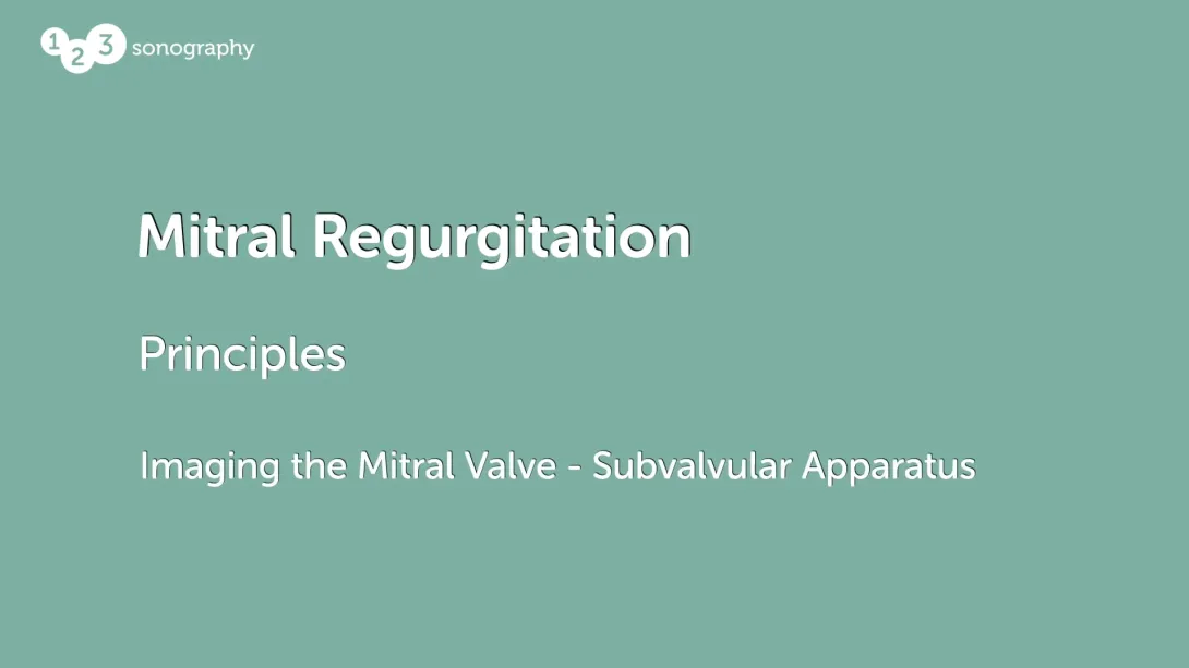 Imaging the Mitral Valve - Subvalvular Apparatus
