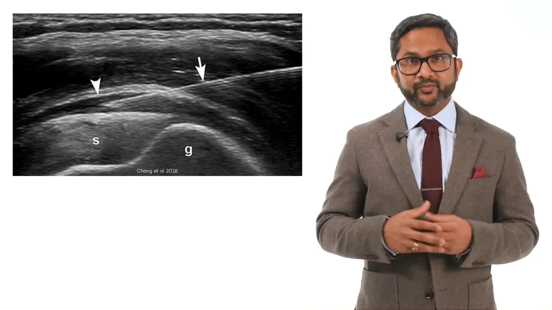 Introduction to the MSK US guided procedures