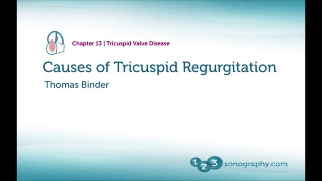 TR Causes