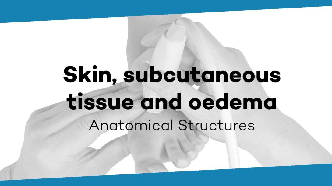 Skin, Subcutaneous tissue and oedema