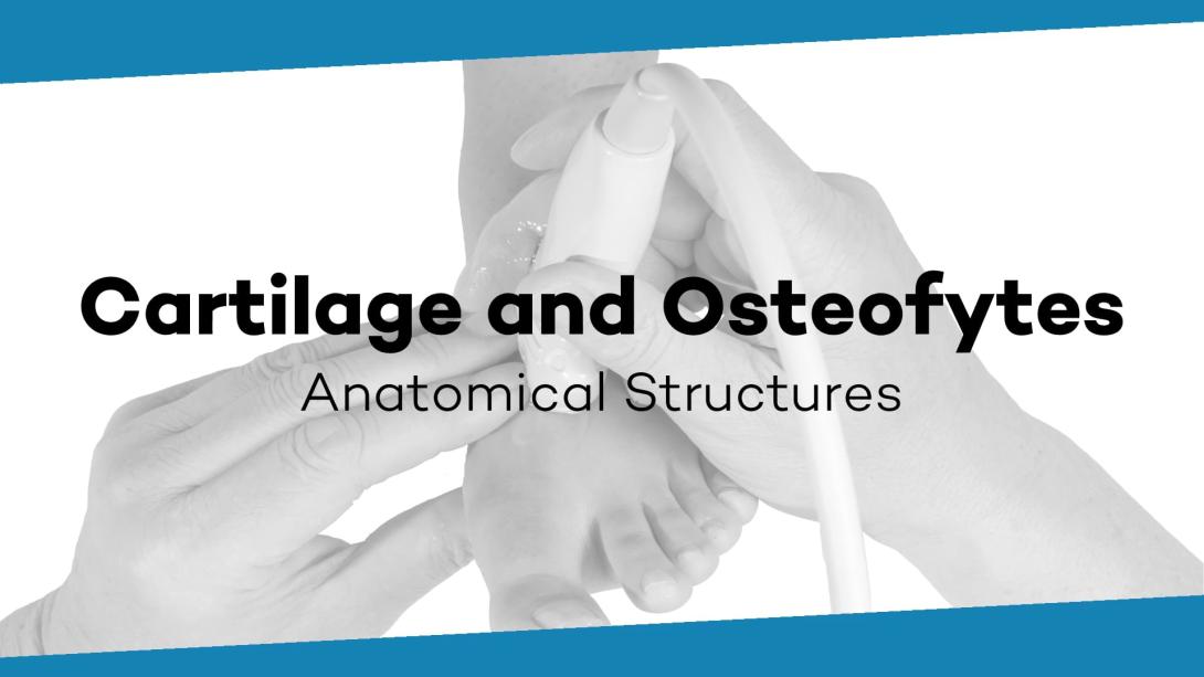 Cartilage and osteophytes