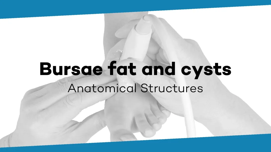 Bursae, fat and cysts