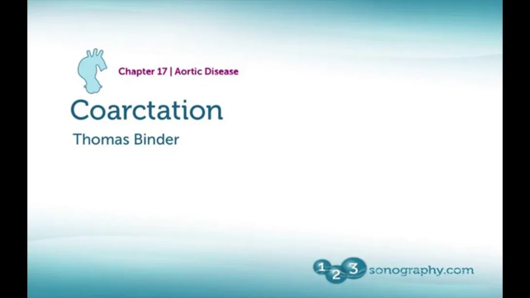 Coarctation