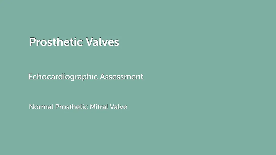 Normal Prosthetic Mitral Valve