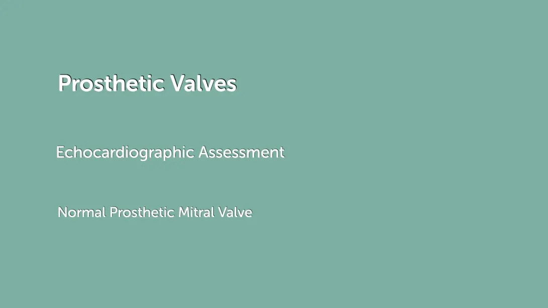 Normal Prosthetic Aortic Valve