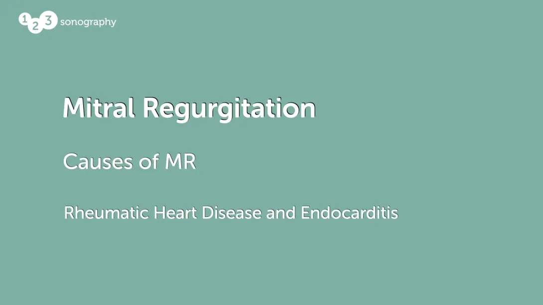 Rheumatic Heart Disease and Endocarditis