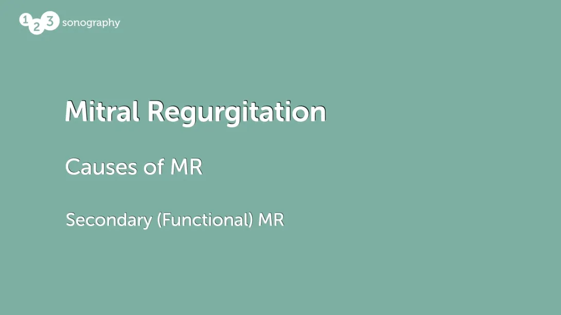 Secondary (Functional) MR