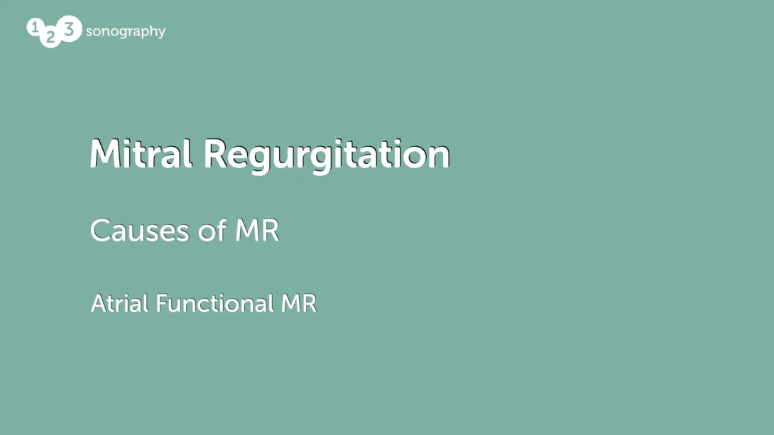 Atrial Functional MR