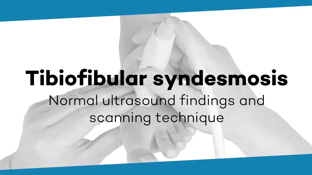Anterior synovial recess and tibiofibular syndesmosis