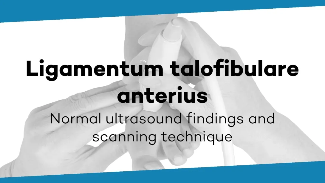 Anterior talofibular ligament, ATFL