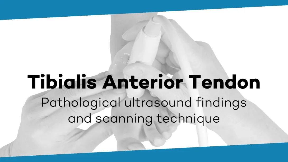 Tibialis anterior