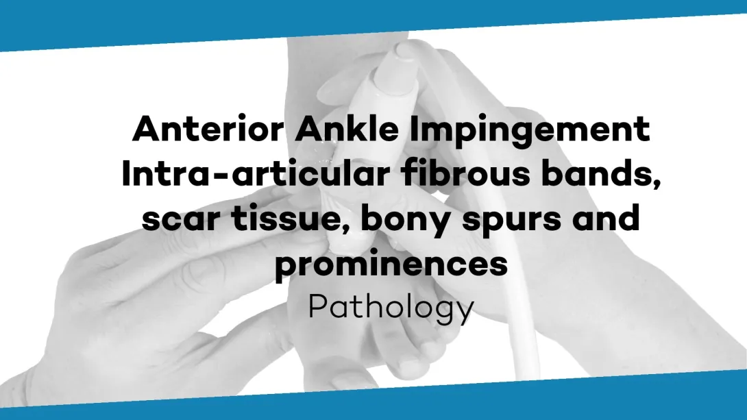 Anterior ankle impingement