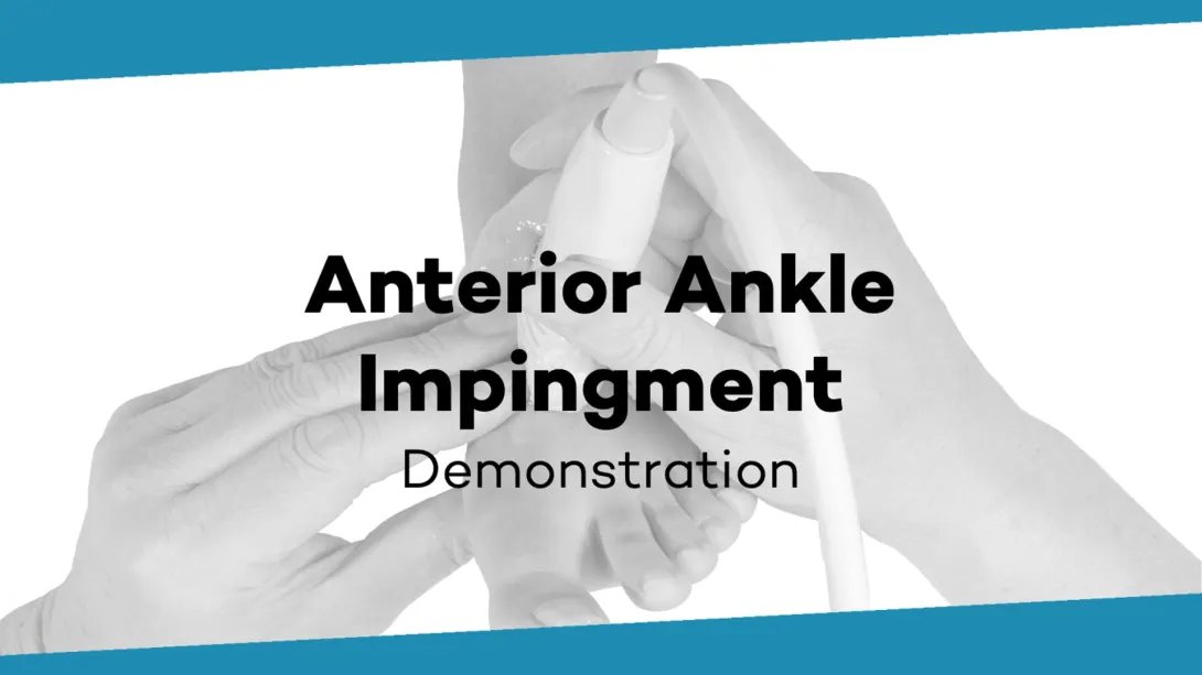 Anterior ankle impingement demo