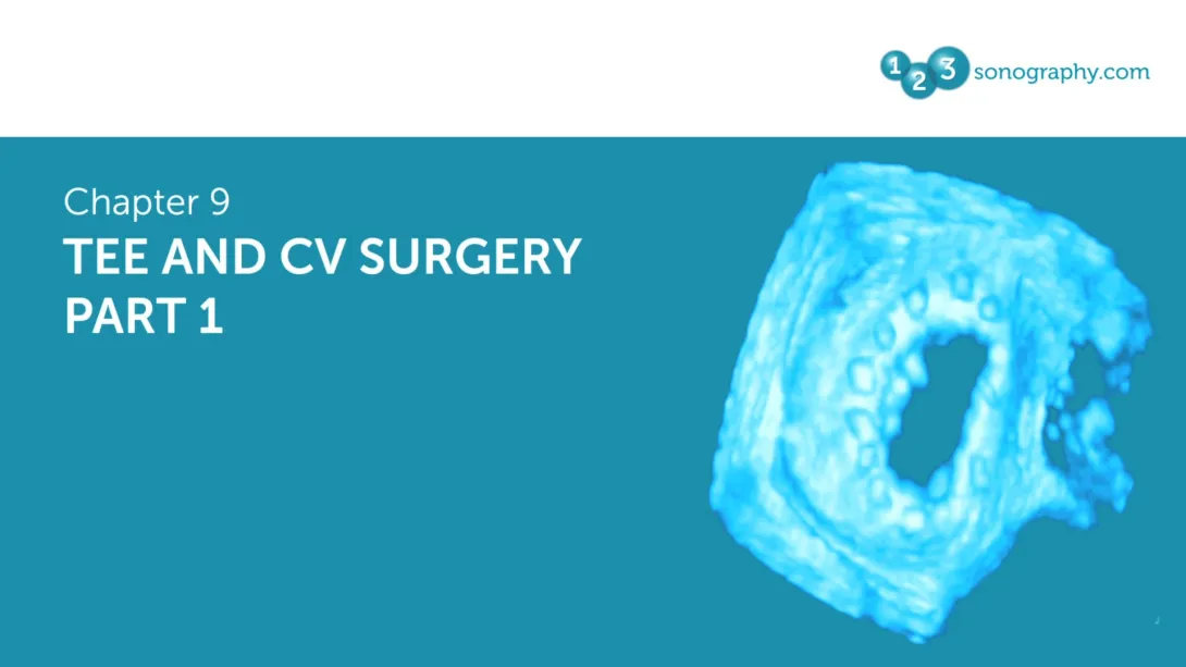 TEE and CV Surgery - Part 1