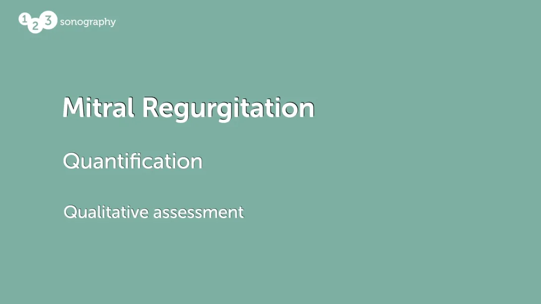 Qualitative Assessment