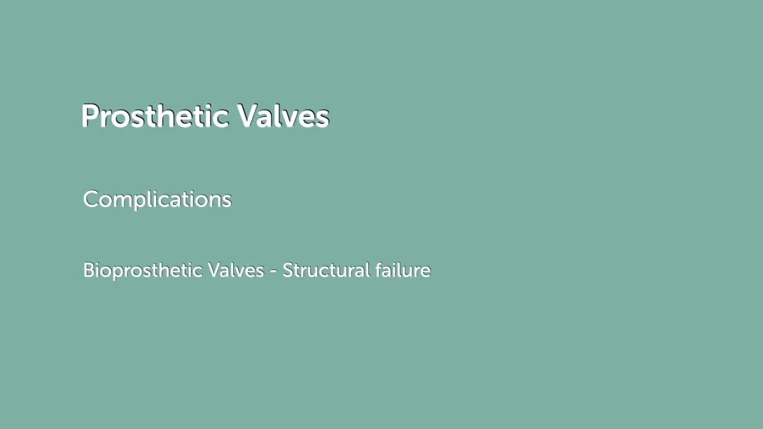 Bioprosthetic Valves - structural failure