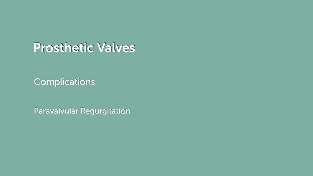Paravalvular Regurgitation