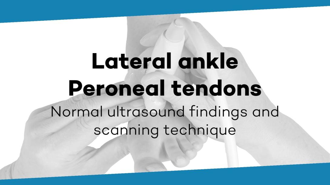Peroneal tendons and retinaculum