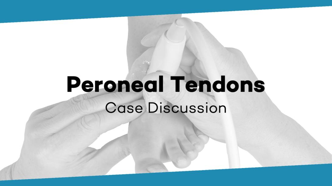 Case Discussion: Peroneal tendons