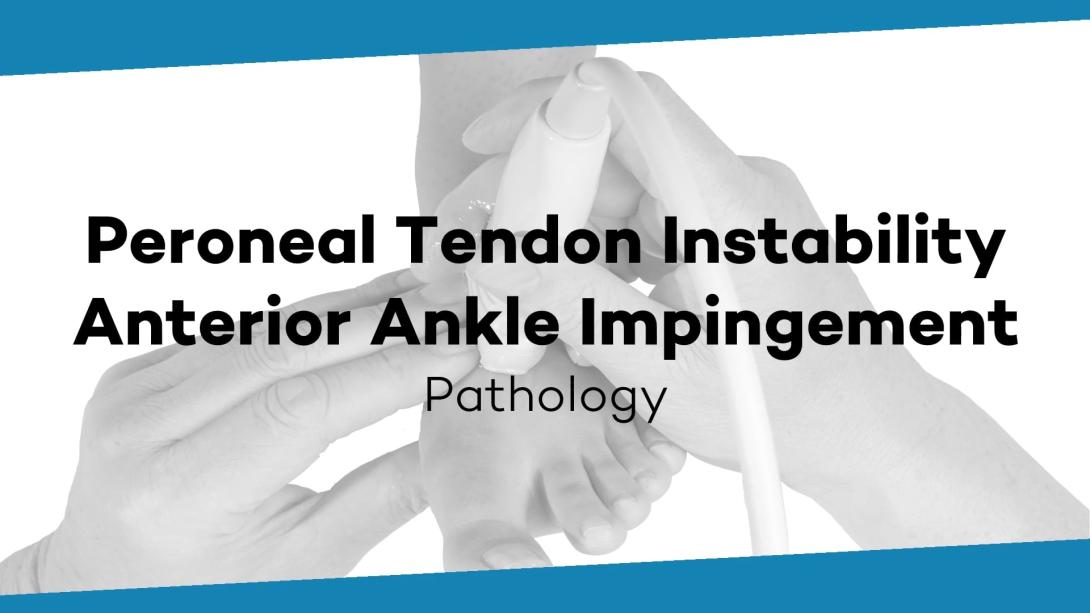 Peroneals - instability and anterior ankle - impingement