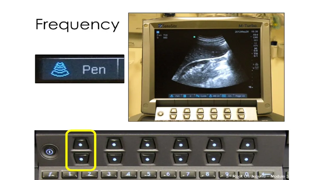 Instrumentation