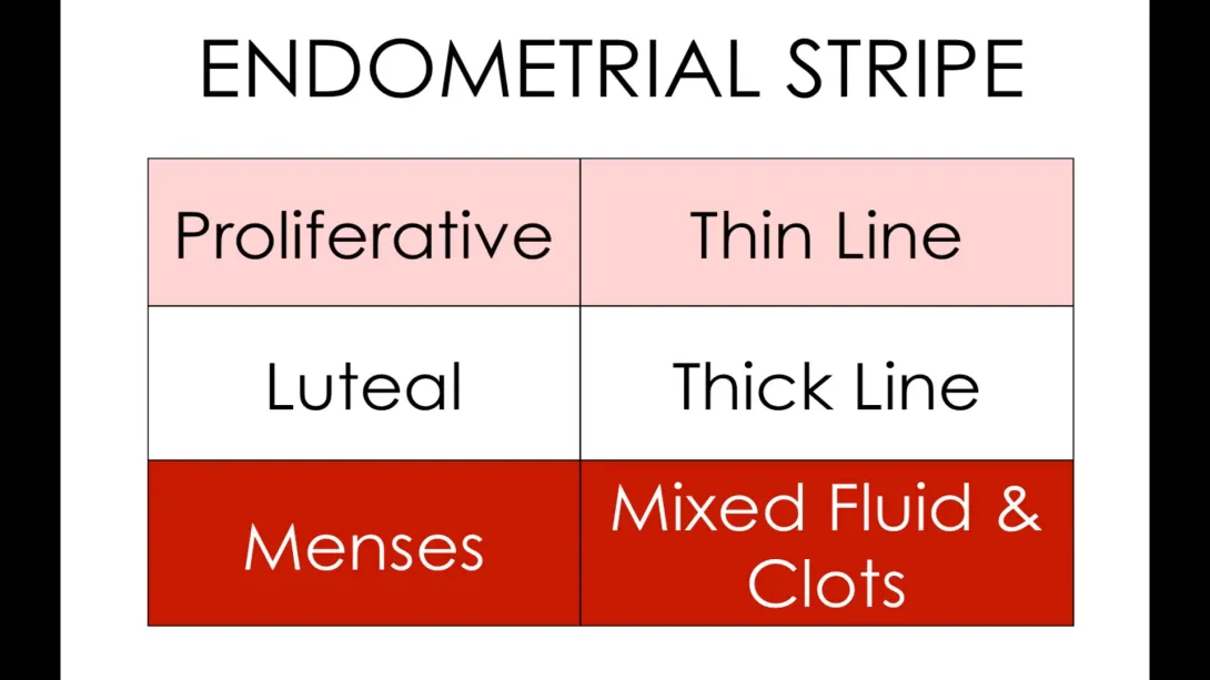 Female Pelvic Anatomy 